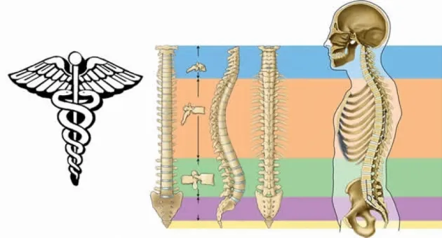 Nucleotomia Discal Stephens