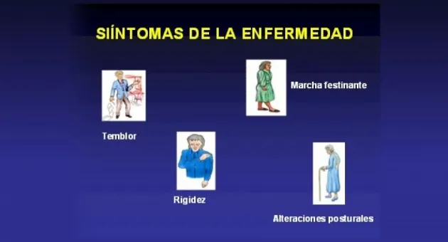 Parkinson Tijuana Neurocirugía